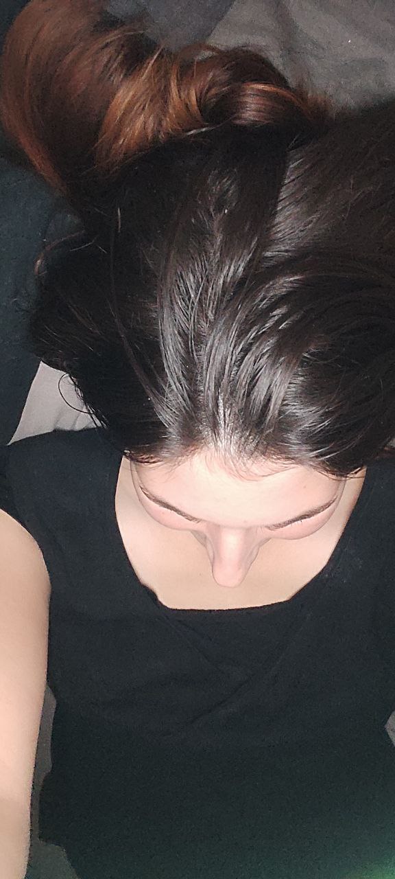 Linda an Tag 16 Frau mit offenen langen Haaren zeigt den Kopf, Nopoo