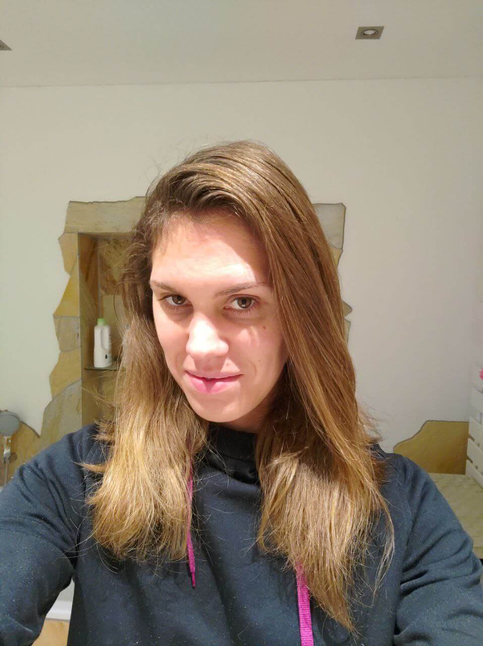 Lisa nach 3 Monaten Nopoo Frau mit offenen langen Haaren, Nopoo